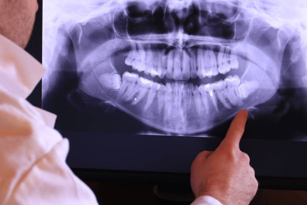 Best Emergency Dental Services for Seniors in Fern Park, FL
