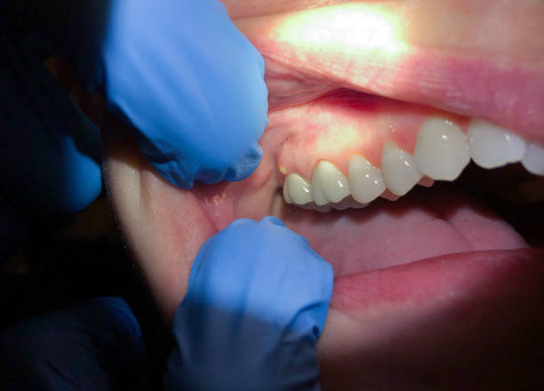 Best Mobile Emergency Dentist in Fern Park, FL
